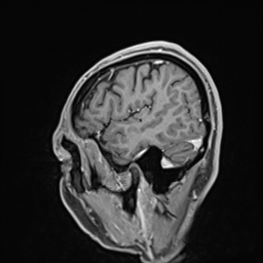 Click on the Serie image to view the images of VILLANUEVA, WILLIAM A.